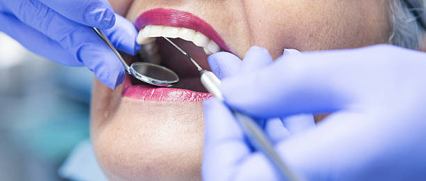 Best Emergency Tooth Extraction in Grenada, MS